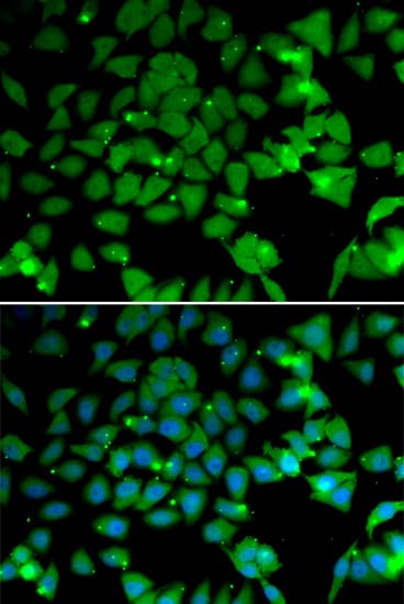 NAA10 / ARD1A Antibody