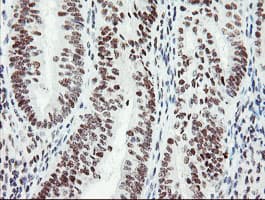 Monoclonal Mouse anti-Human SENP2 Antibody (clone OTI1H2, IHC, IF, WB)