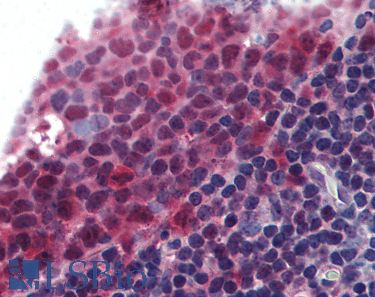 IHC-plus™ Polyclonal Rabbit anti-Human BAFF / TNFSF13B Antibody (aa254-269, IHC, WB)