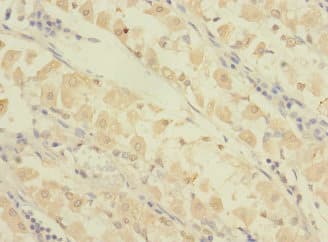 GRAMD1B Antibody