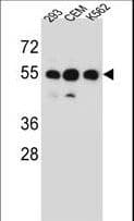 Polyclonal Rabbit anti-Human ZNF562 Antibody (aa4-33, WB)