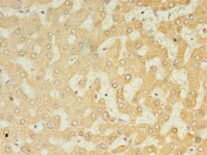 UGT2B4 Antibody