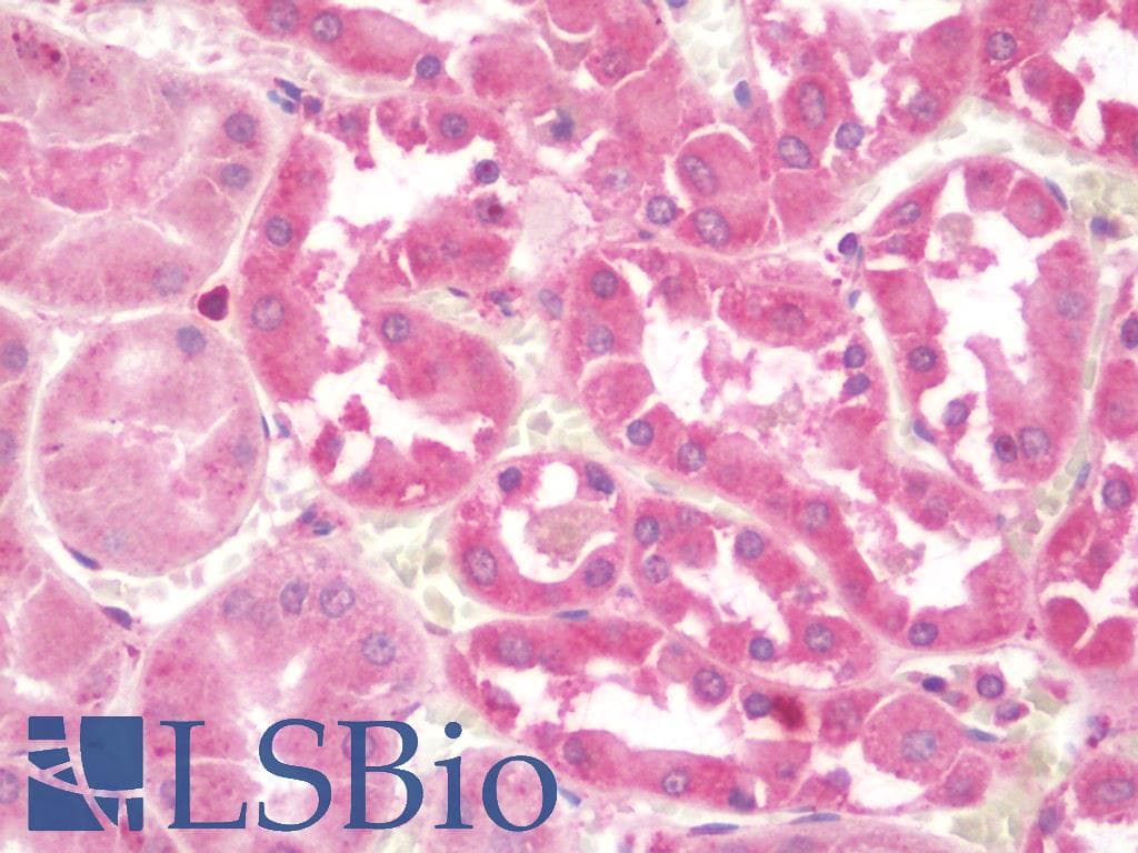 IHC-plus™ Polyclonal Rabbit anti-Human ULK1 Antibody (IHC, IF, WB)