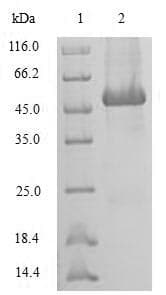 Human Statherin / STR Protein (Recombinant 10His-SUMO, N-terminus)