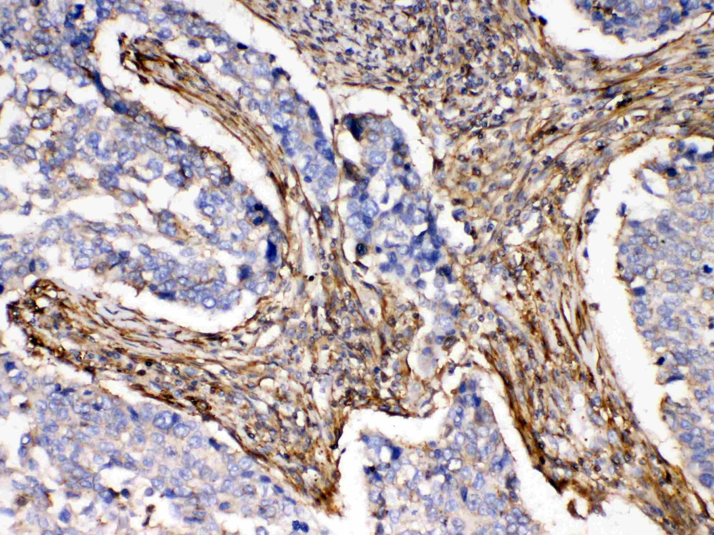 ACTN3 Antibody