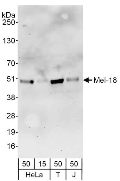 Polyclonal Rabbit anti-Human PCGF2 / MEL-18 Antibody (aa125-175, WB)