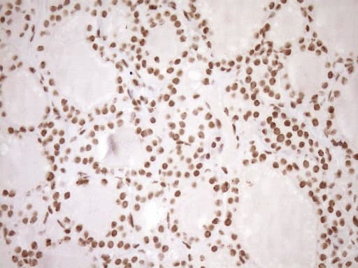 EXOSC1 / CSL4 Antibody (clone OTI1H9, Carrier-free)