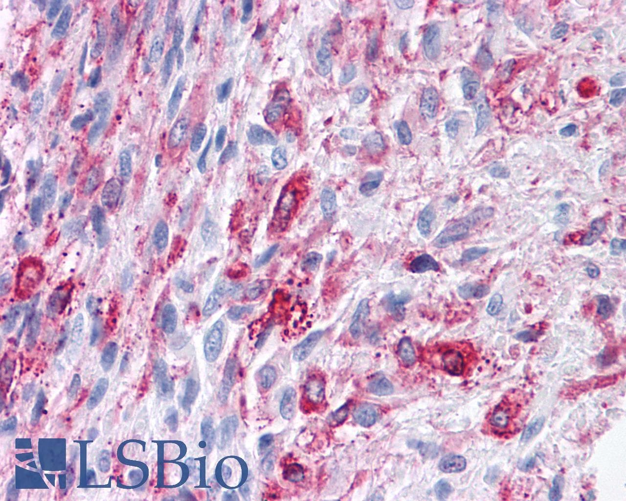 PathPlus™ FZD1 / Frizzled 1 Antibody (N-Terminus)