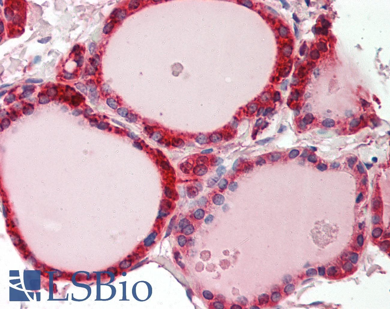 Polyclonal Rabbit anti-Human CALR / Calreticulin Antibody (aa213-262, IHC, WB)