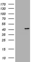 MUC16 / CA125 Antibody (clone OTI3B6)