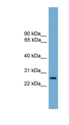 LRRC3 Antibody (aa107-156)
