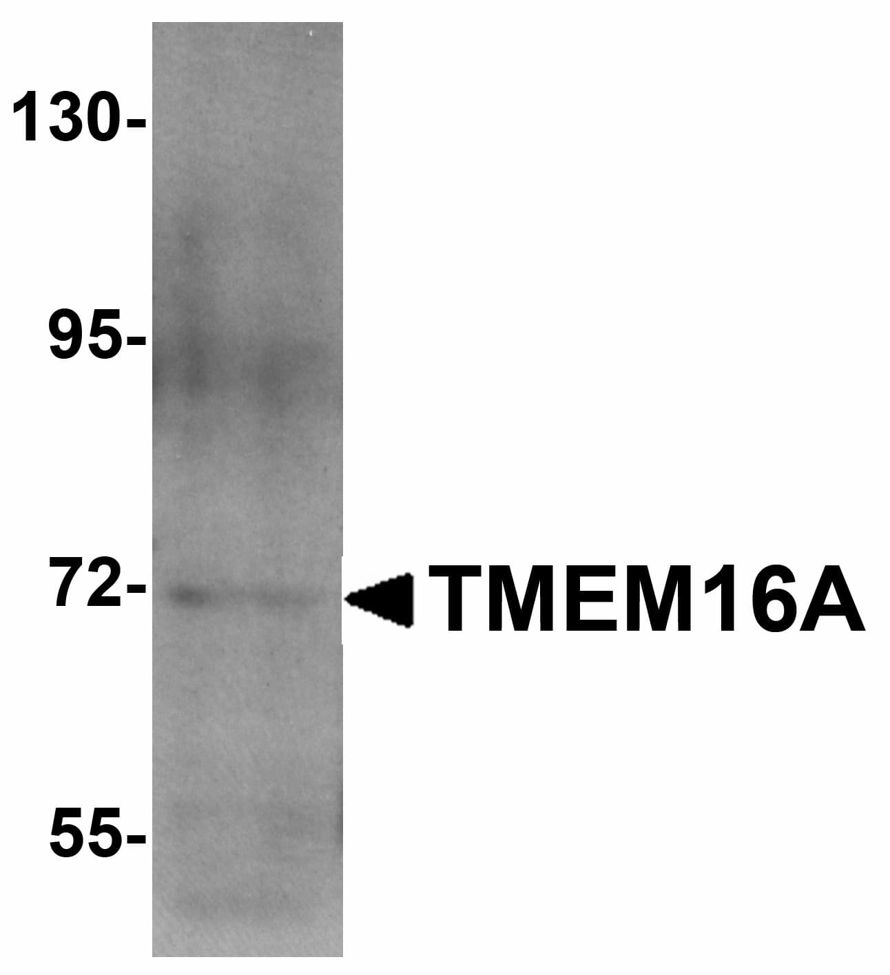 Polyclonal Rabbit anti-Human ANO1 / DOG1 / TMEM16A Antibody (WB)