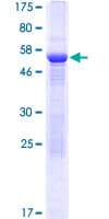 Human RRP15 Protein (Recombinant GST)