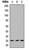 Polyclonal Rabbit anti-Human LYL1 Antibody (Internal, IHC, WB)