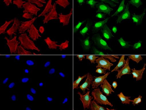 ERCC1 Antibody (clone 2.00E+12, Carrier-free)