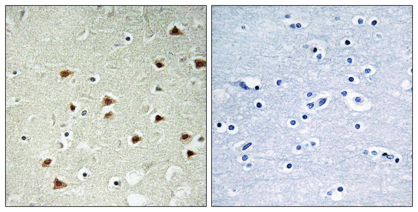 ABHD14B Antibody