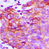Polyclonal Rabbit anti-Human CLDN1 / Claudin 1 Antibody (C-Terminus, IHC, WB)