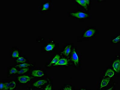 Polyclonal Rabbit anti-Human CXCL11 Antibody (IHC, IF)