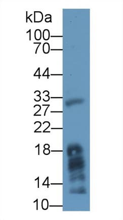 MGLL / Monoacylglycerol Lipase Antibody (aa1-303, Biotin)