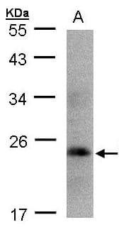 IHC-plus™ GH / Growth Hormone Antibody