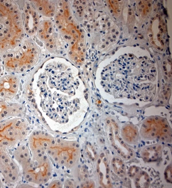 Polyclonal Rabbit anti-Human SLC17A3 Antibody (aa2-50, IHC)