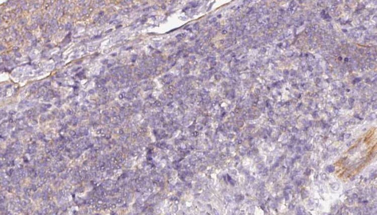 Polyclonal Rabbit anti-Human MTHFD2 Antibody (IHC, IF, WB)