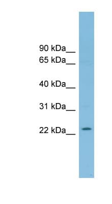 RNF125 / TRAC-1 Antibody (C-Terminus)