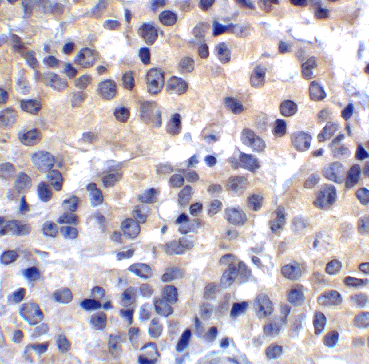 IHC-plus™ Monoclonal Mouse anti-Human VSIR / GI24 / VISTA Antibody (clone 4C4, IHC, IF, WB)