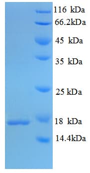 Mycobacterium tuberculosis MPT63 Protein (Recombinant His)