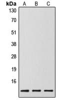 Polyclonal Rabbit anti-Human CASP14 / Caspase 14 Antibody (Internal, WB)