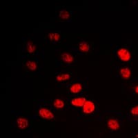 IP6K2 Antibody (Internal)