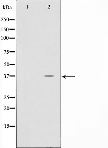 NPM1 / NPM / Nucleophosmin Antibody