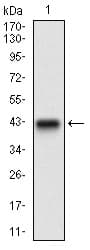 ZEB1 / AREB6 Antibody (aa967-1108, clone 2A8H3)