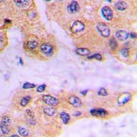Polyclonal Rabbit anti-Human SMAD3 Antibody (phospho-Ser213, IHC, IF, WB)