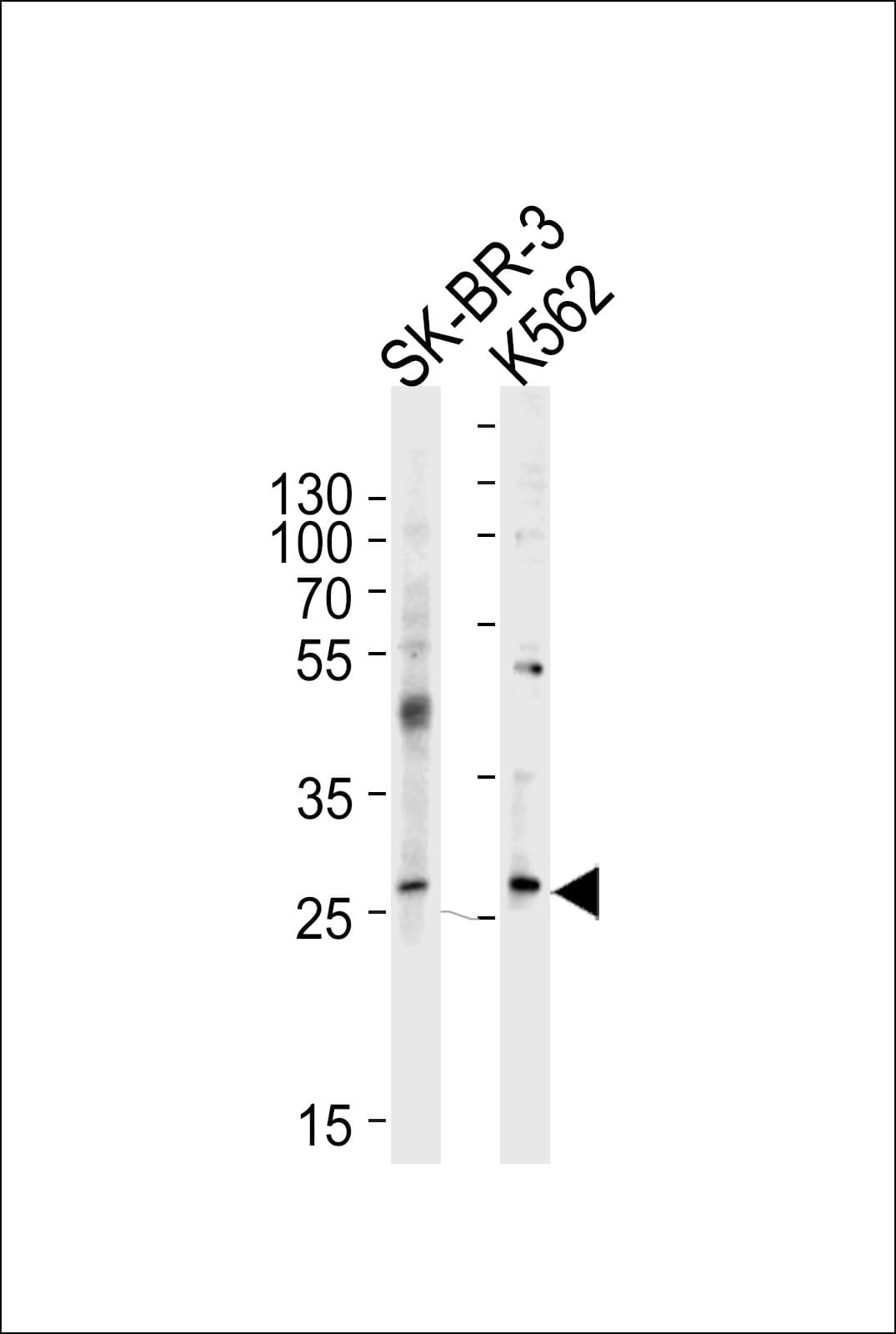 FRAT1 Antibody (aa244-274)