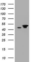 EPHX1 / Epoxide Hydrolase 1 Antibody (aa21-230, clone OTI2D8)