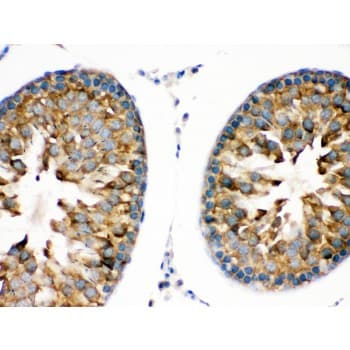 TRPM5 Antibody (aa1021-1108)