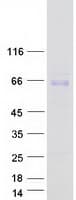Human ACHE / Acetylcholinesterase Protein (Recombinant Myc-DDK (Flag))