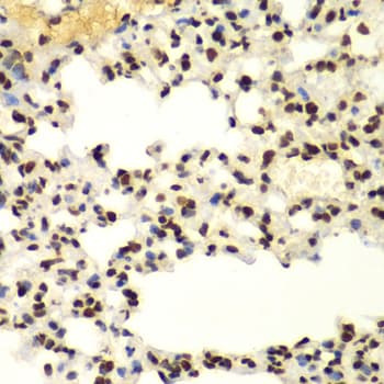 SUMO2 Antibody