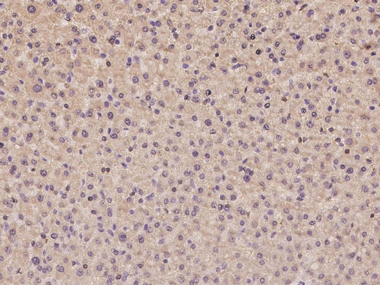 AIM2 Antibody