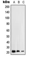 Polyclonal Rabbit anti-Human TTF / RHOH Antibody (C-Terminus, IHC, WB)