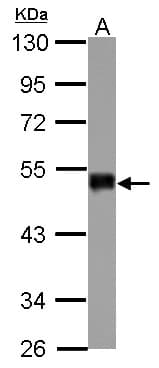 Polyclonal Rabbit anti-Human SNIP1 Antibody (IHC, WB)