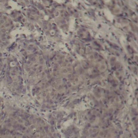 Polyclonal Rabbit anti-Human CREB1 / CREB Antibody (phospho-Ser142, IHC)
