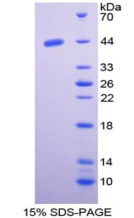 Human NISCH Protein (Recombinant His-GST)