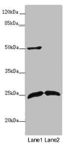ARHGDIG / RHOGDI-3 Antibody