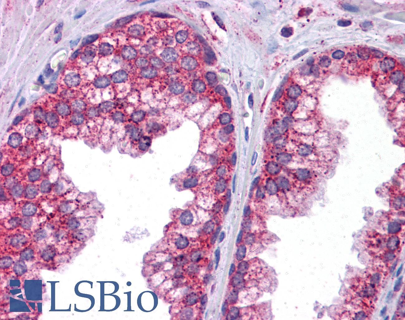 Polyclonal Rabbit anti-Human STAT6 Antibody (aa614-663, IHC, WB)