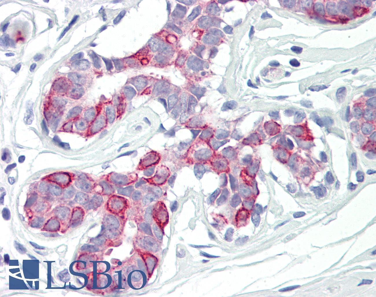 IHC-plus™ Polyclonal Rabbit anti-Human PKMYT1 Antibody (aa49-98, IHC, WB)