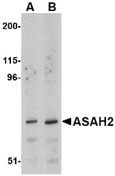IHC-plus™ ASAH2 Antibody