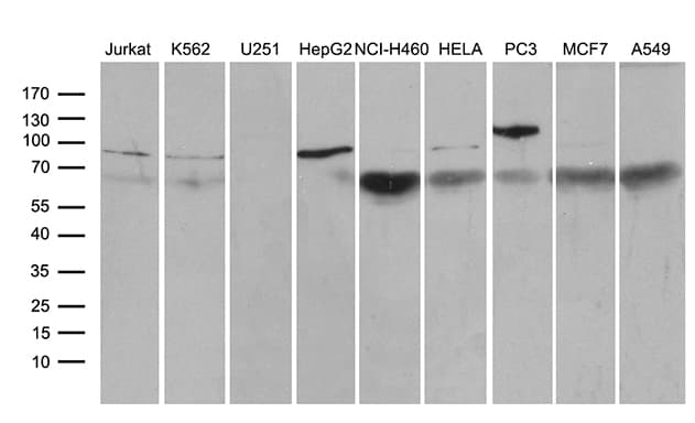 SF1 Antibody (aa1-276, clone OTI4C9)