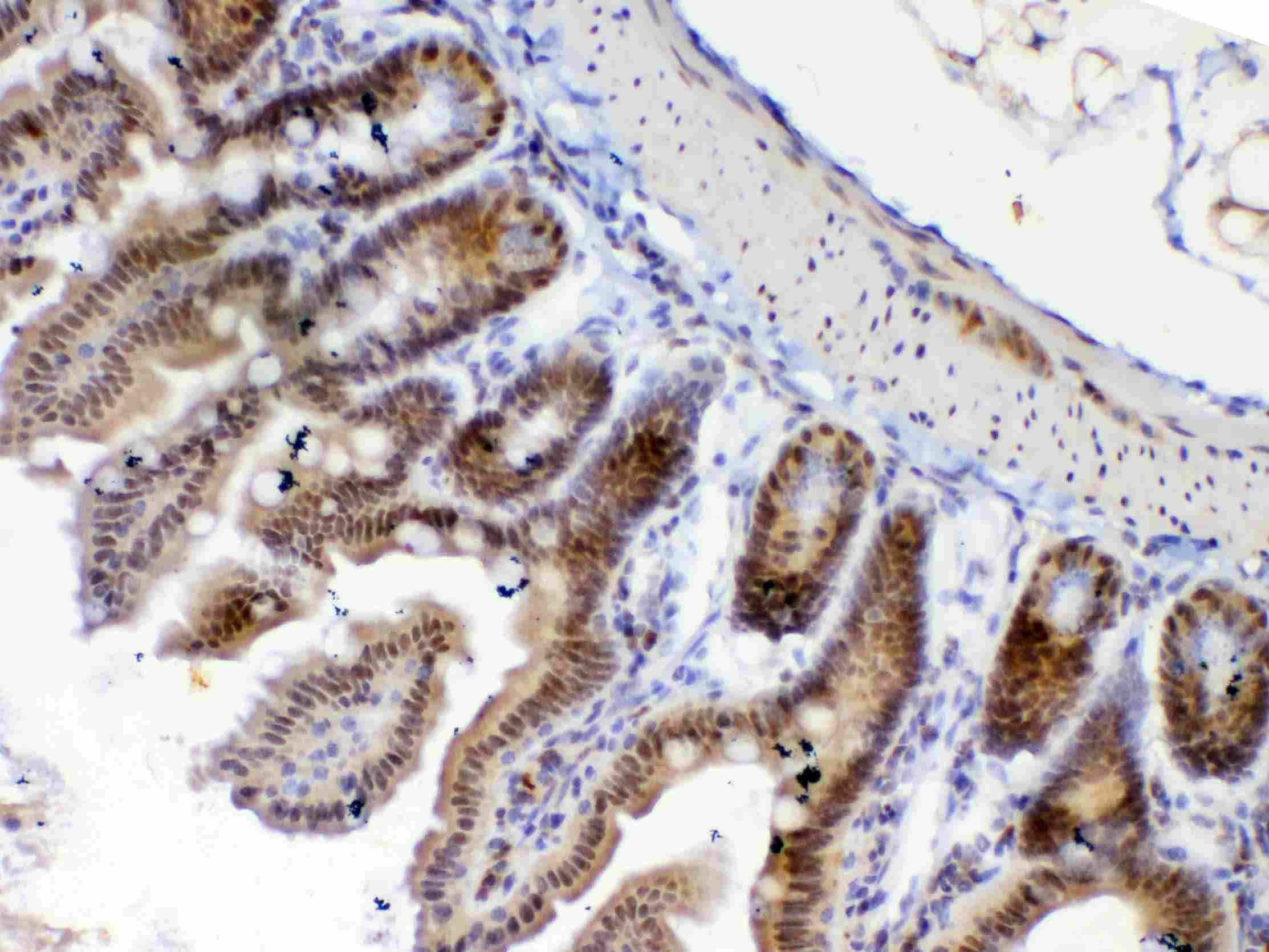 Polyclonal Rabbit anti-Human ETV6 / TEL Antibody (IHC, WB)